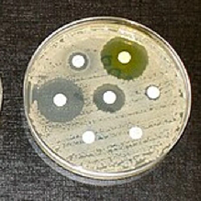 Risk of AMR in the environment